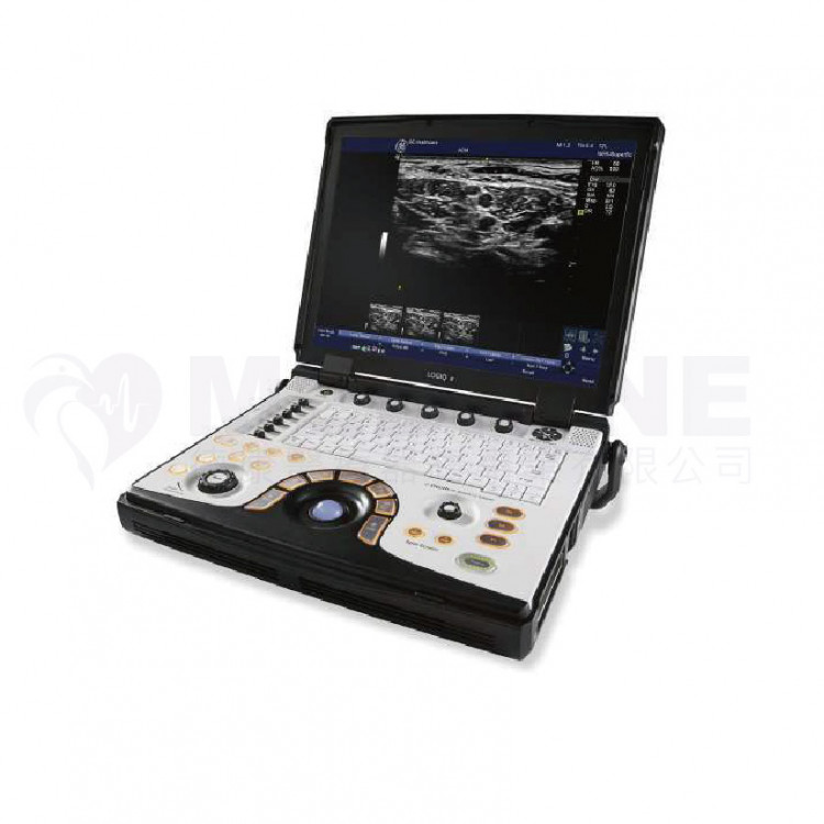 奇異 超音波影像系統